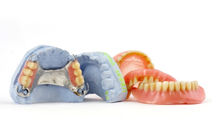 Exploring the Benefits of Partial Dentures