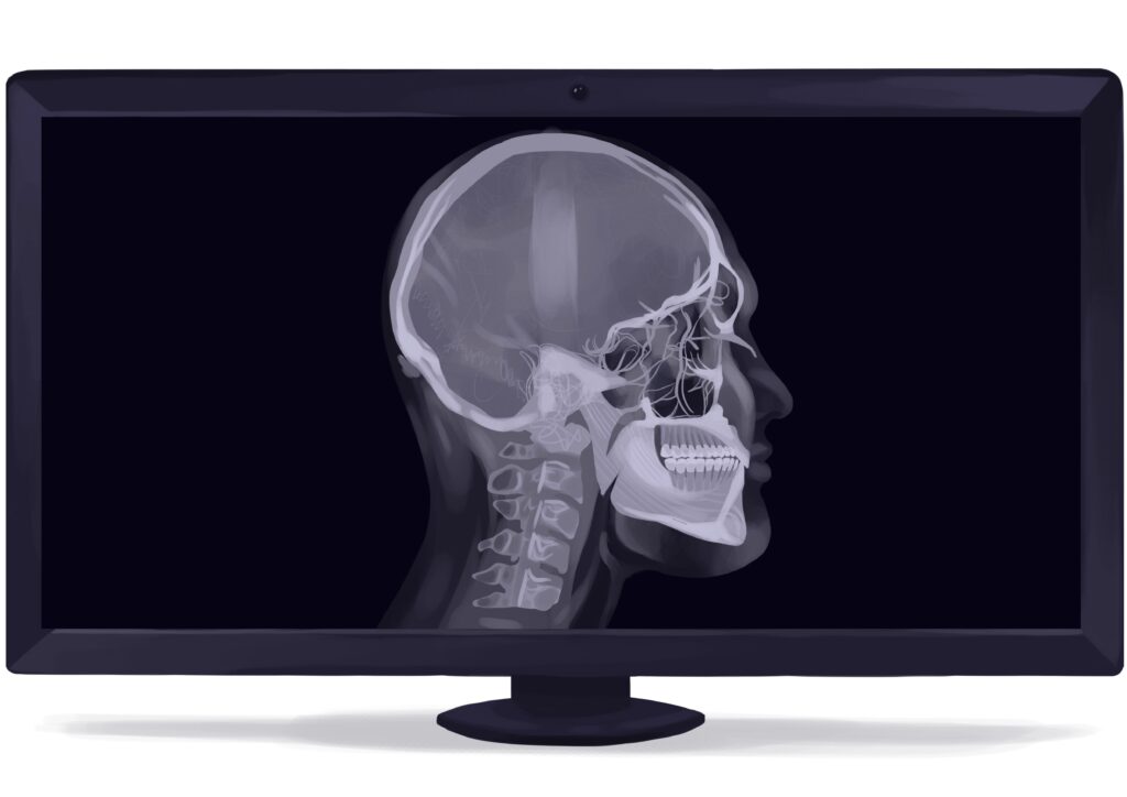 cephalometric-dental-x-ray-digital-technical-picture_50777133442_o