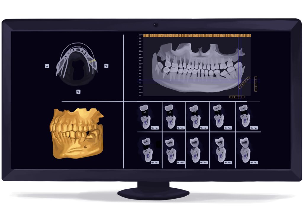 cone-beam-computed-tomography-cbct-dental-x-ray-digital-technical-picture_50777133467_o