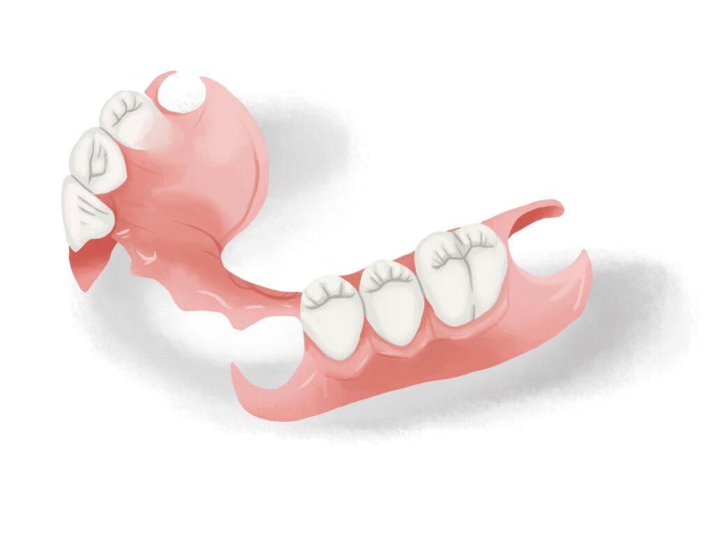 flexible-partial-dentures-clear-base-technical-picture_50729002953_o