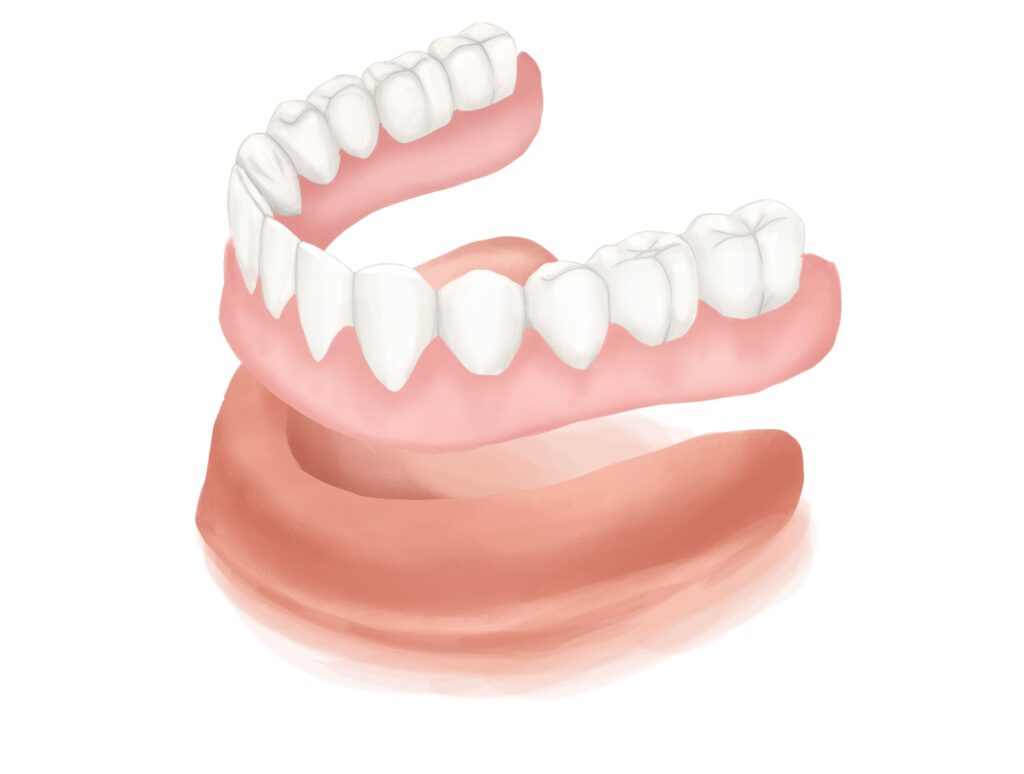 full-lower-dentures-clear-gums-technical-picture_50729828607_o