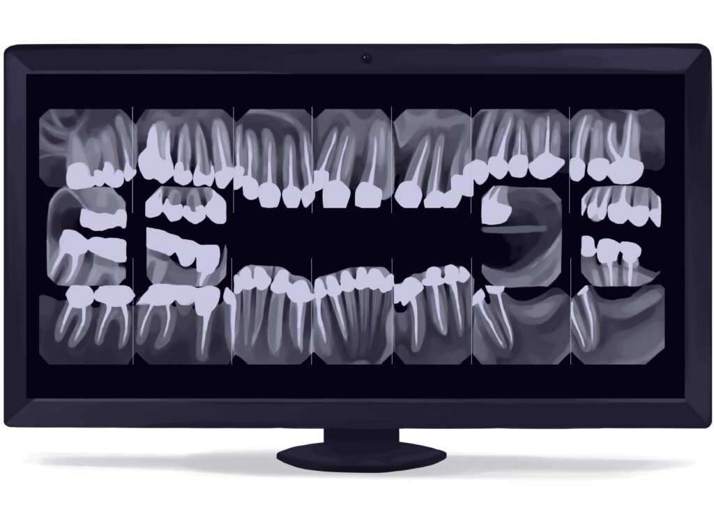 full-moth-fmx-dental-x-rays-digital-technical-picture_50777020581_o