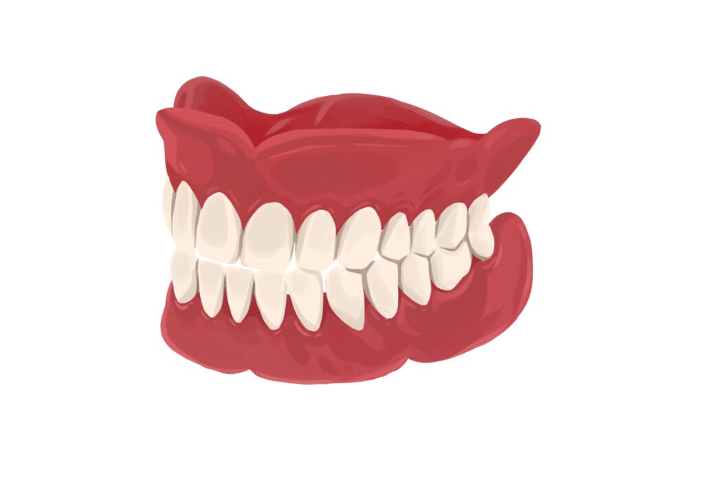 full-upper-and-lower-dentures-profile-view-technical-picture_50729828447_o