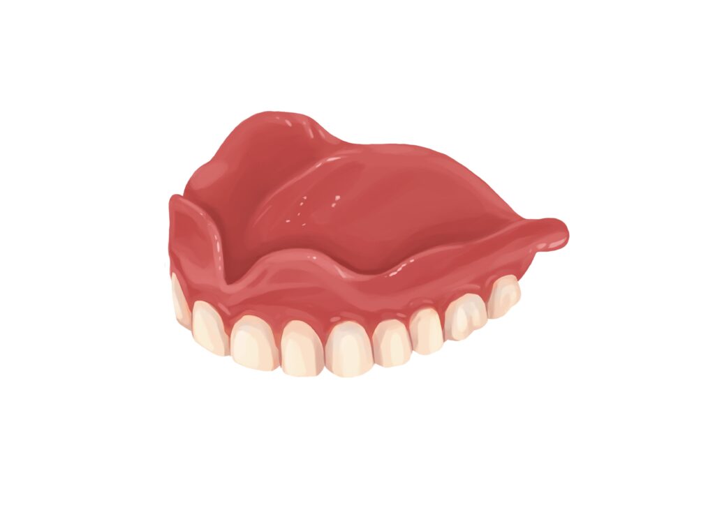 full-upper-dentures-technical-picture_50729732921_o