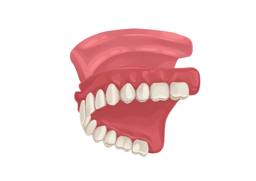 full-upper-dentures-with-palate-technical-picture_50729828377_o