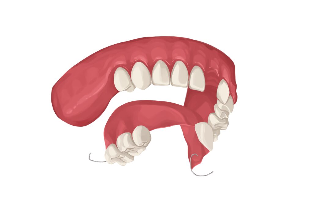 interim-partial-dentures-for-upper-arch-technical-picture_50729002623_o