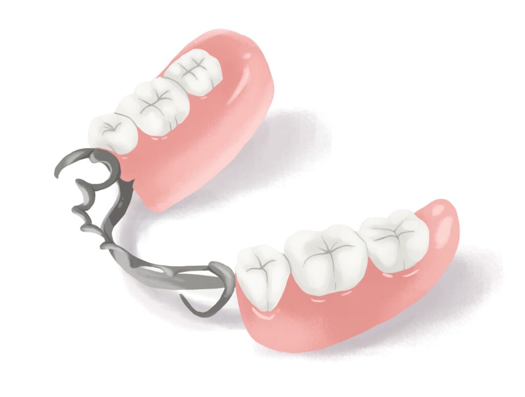 metal-partial-dentures-clear-base-technical-picture_50729002933_o