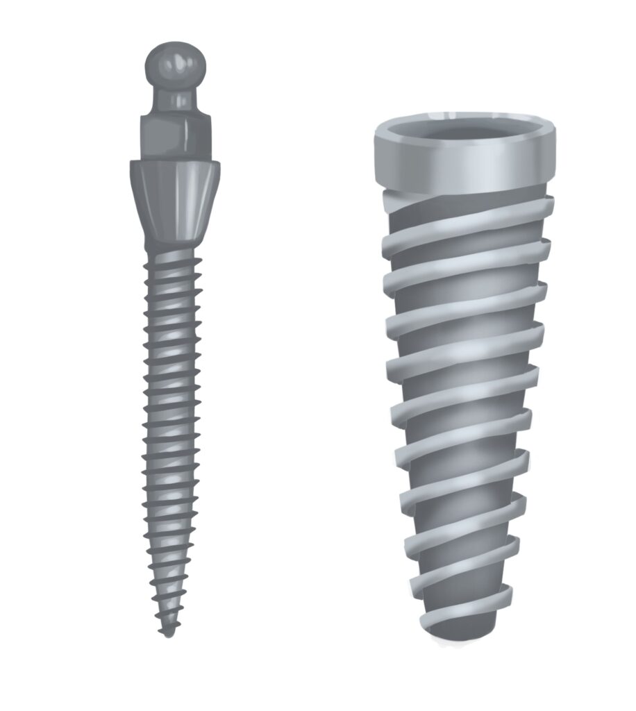 mini-vs-traditional-dentalimplant-technical-picture_50730990957_o