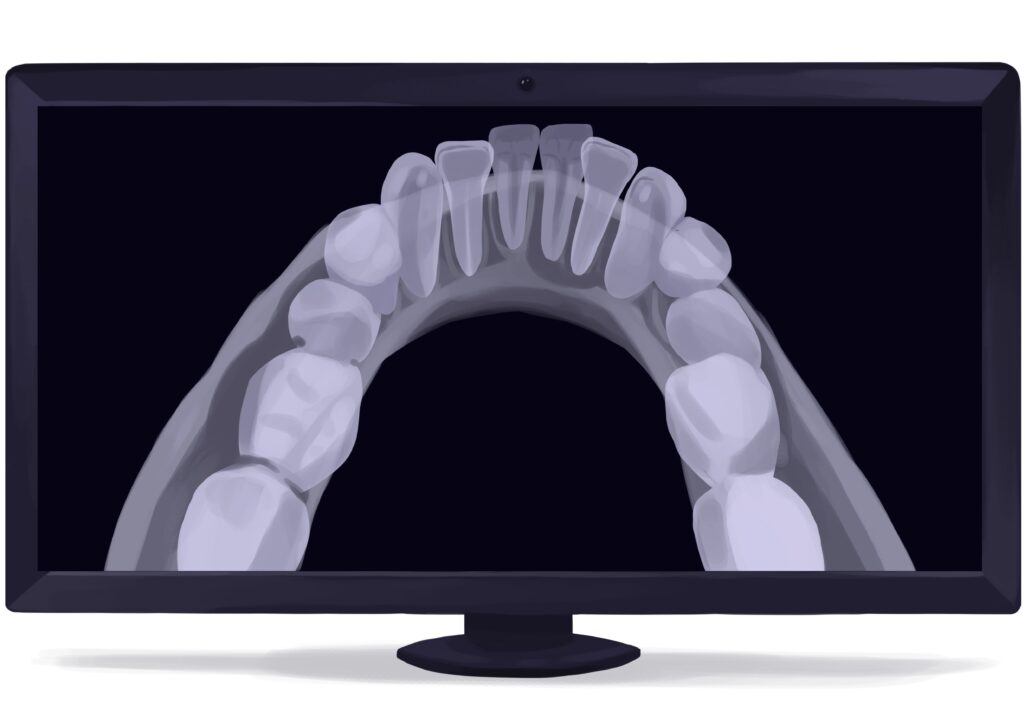 occlusal-dental-x-ray-digital-technical-picture_50776264383_o