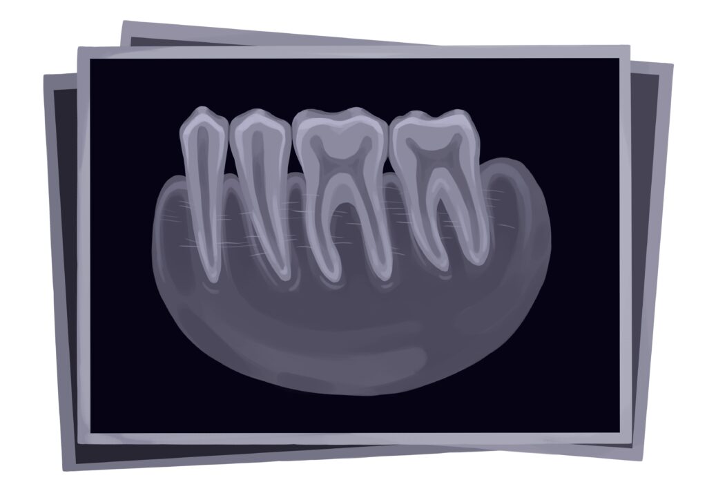 periapical-pa-dental-x-rays-technical-picture_50776264463_o