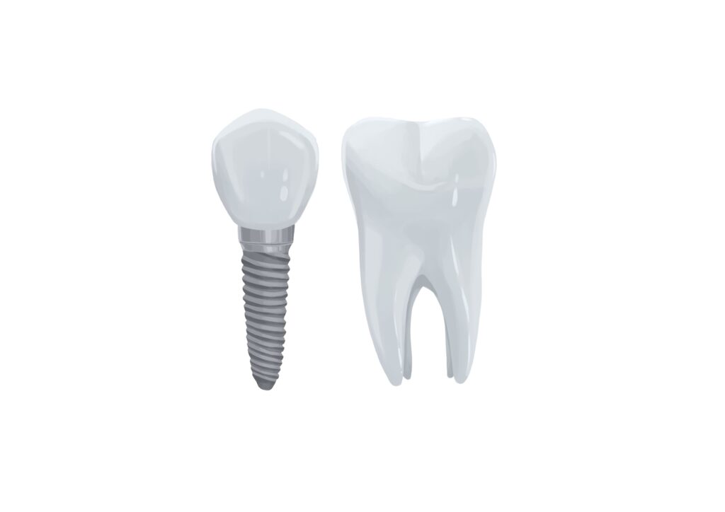 tooth-implant-next-to-molar-tooth-technical-picture_50730991202_o