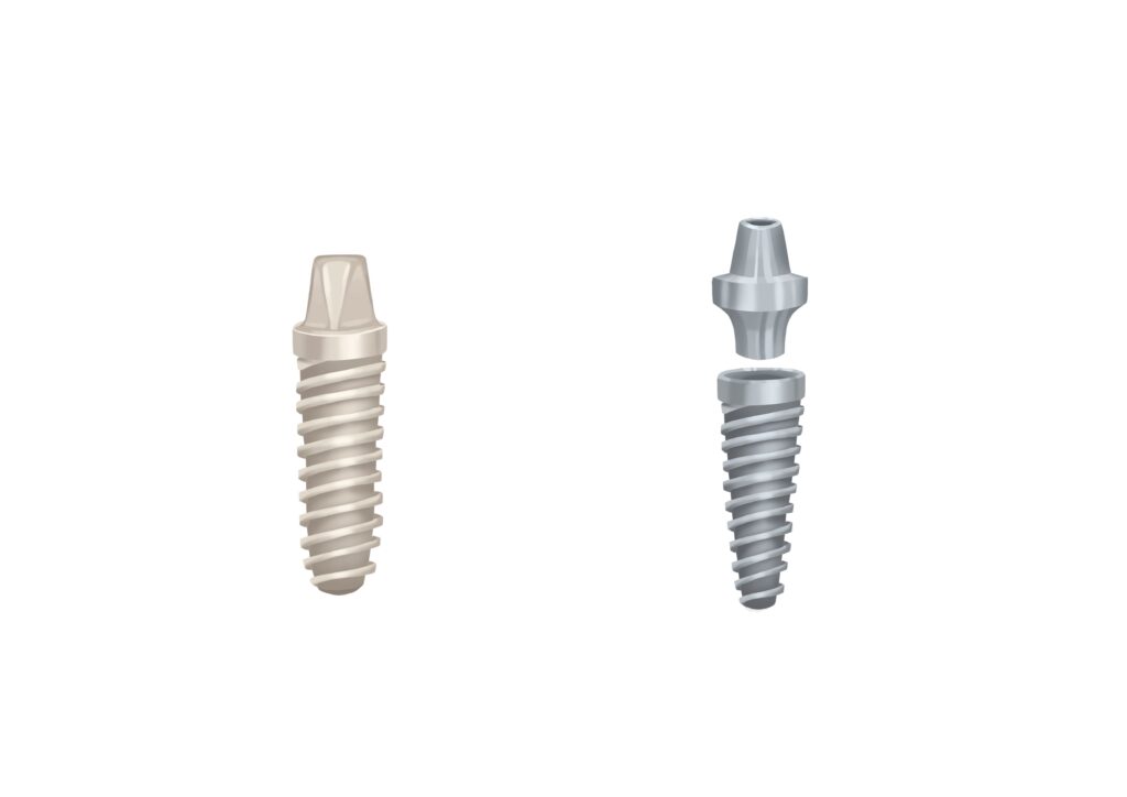 zirconia-vs-titanium-dental-implant-technical-picture_50730165663_o